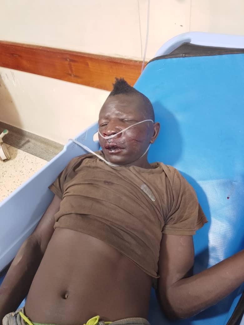 One of the injured victims receiving treatment